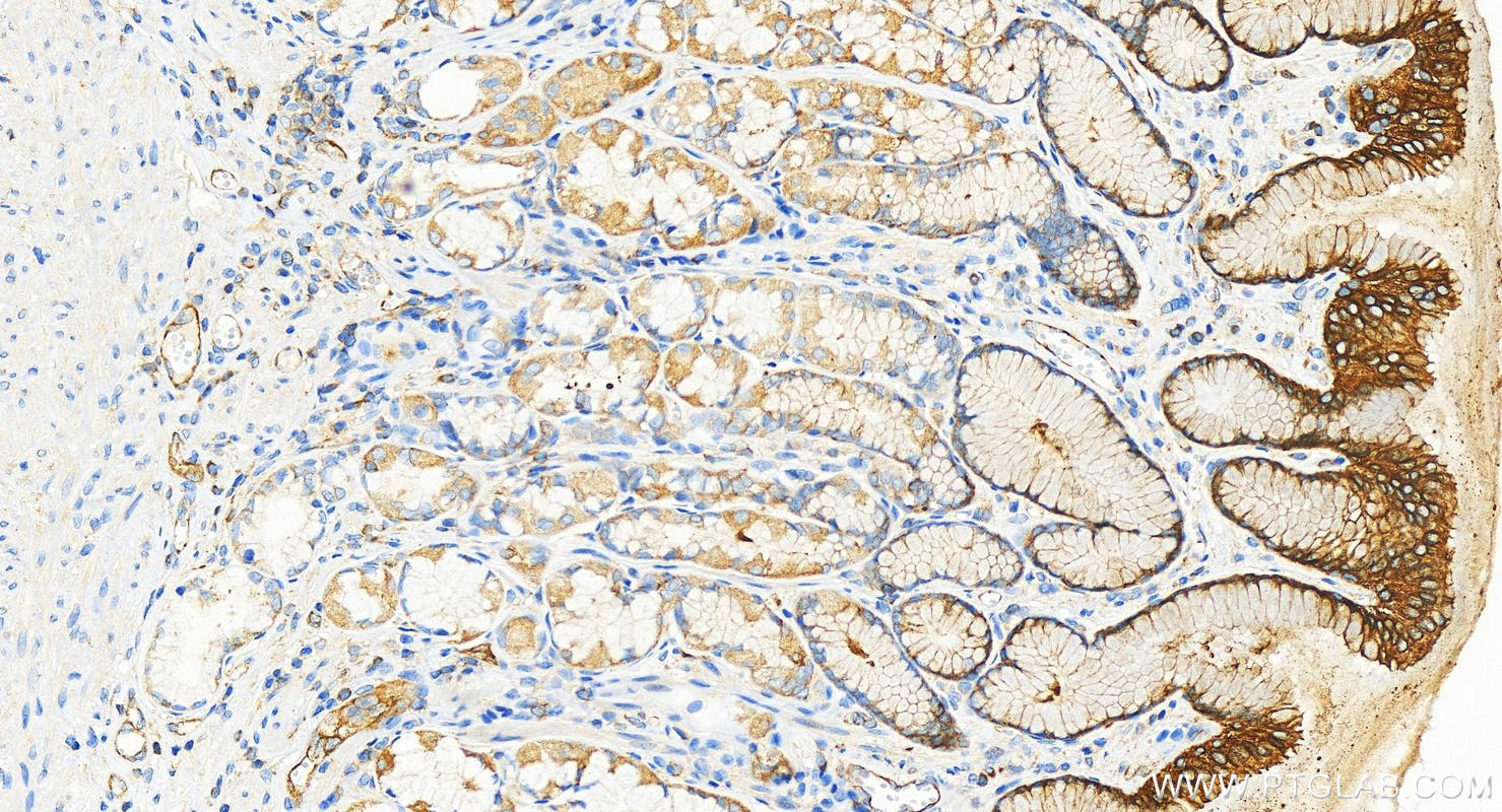 IHC staining of human stomach using 82969-1-RR (same clone as 82969-1-PBS)