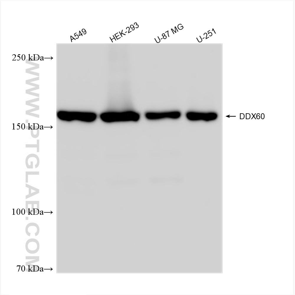 WB analysis using 82969-1-RR (same clone as 82969-1-PBS)