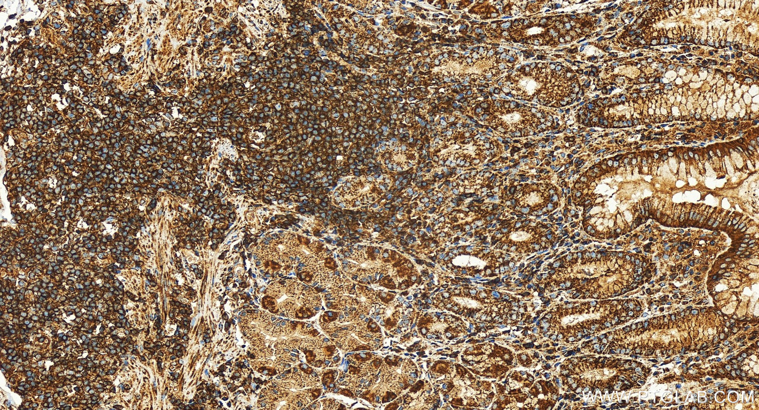 IHC staining of human stomach using 82969-4-RR (same clone as 82969-4-PBS)