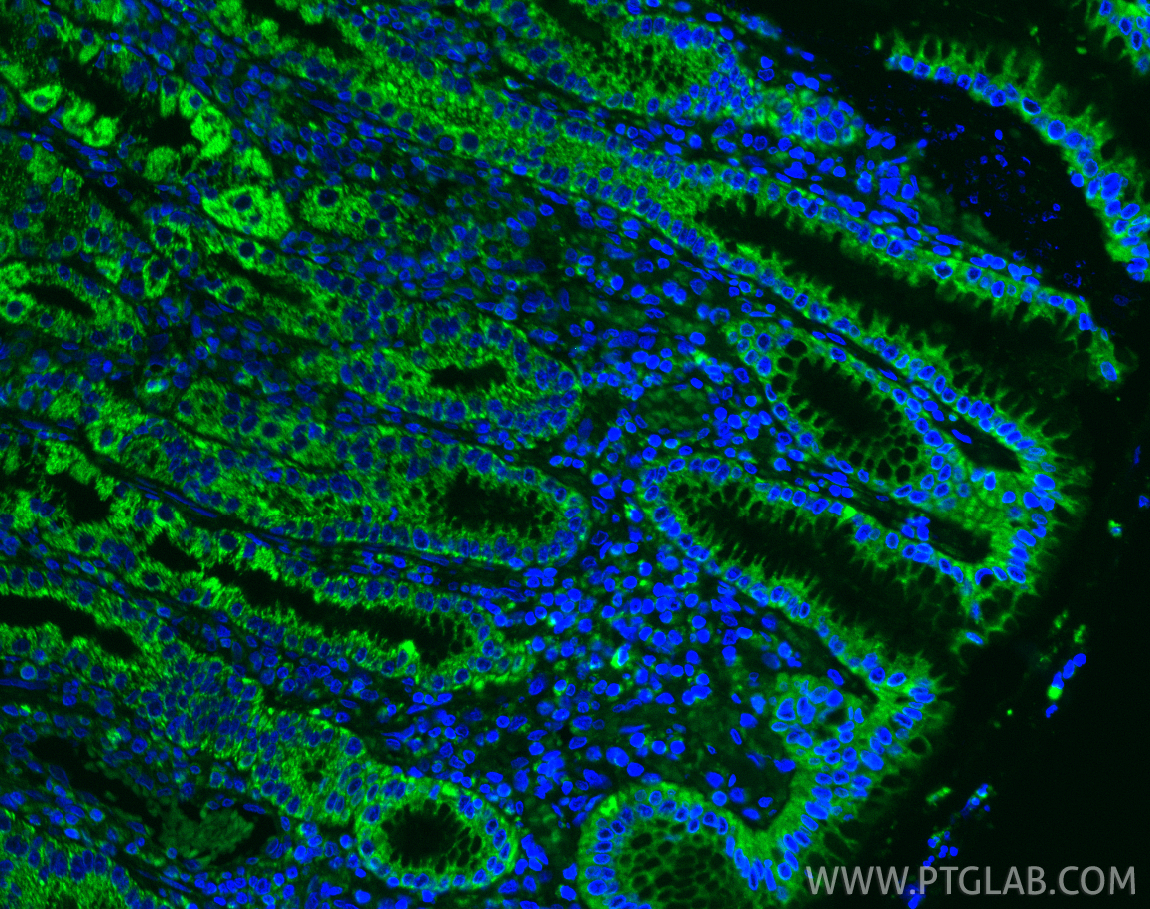 IF Staining of human stomach using 82969-4-RR (same clone as 82969-4-PBS)