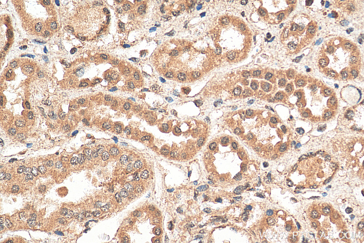 IHC staining of human kidney using 18323-1-AP