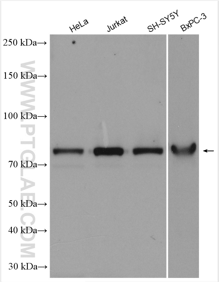 WB analysis using 18323-1-AP