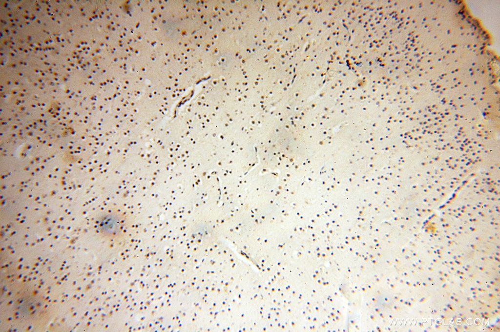 IHC staining of human brain using 14574-1-AP