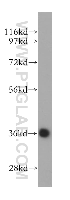 WB analysis of HEK-293 using 14574-1-AP