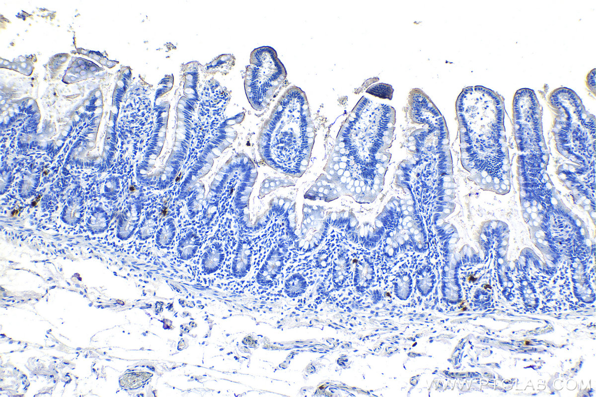 IHC staining of human small intestine using 67156-1-Ig