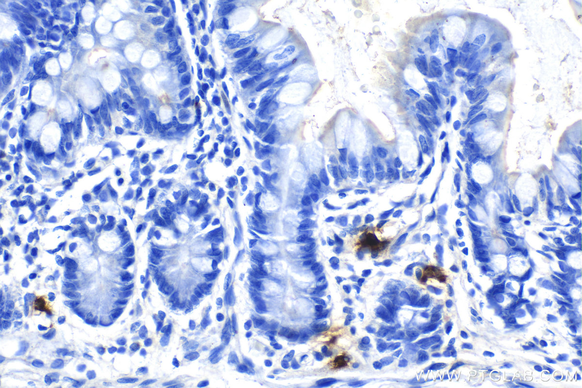 IHC staining of human small intestine using 67156-1-Ig
