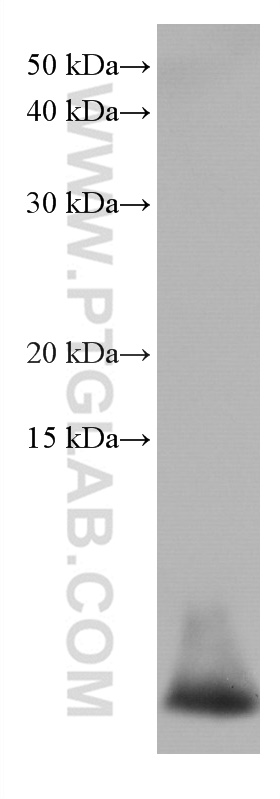 WB analysis of human peripheral blood leukocyte using 67156-1-Ig