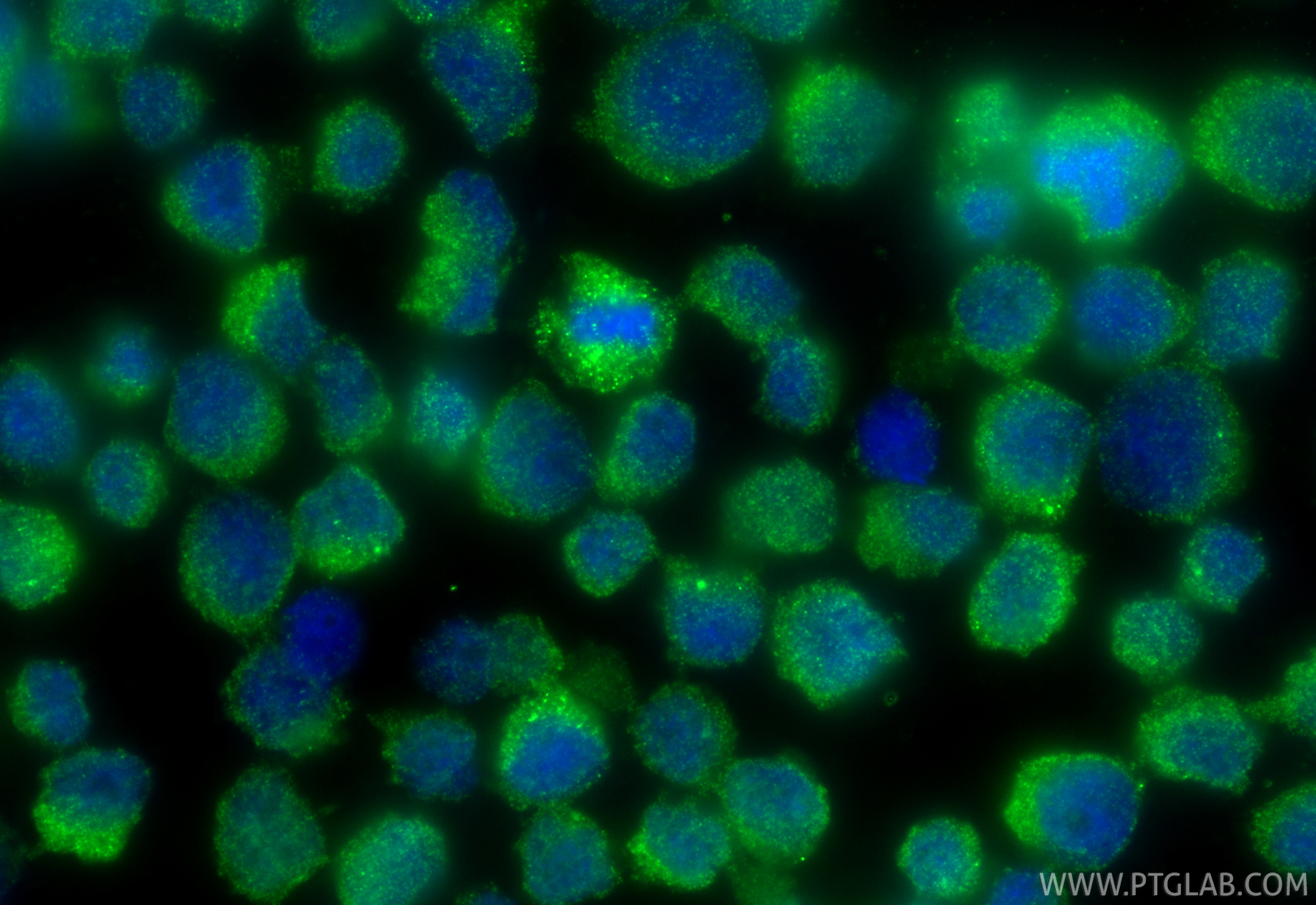 IF Staining of COLO 320 using 17923-1-AP