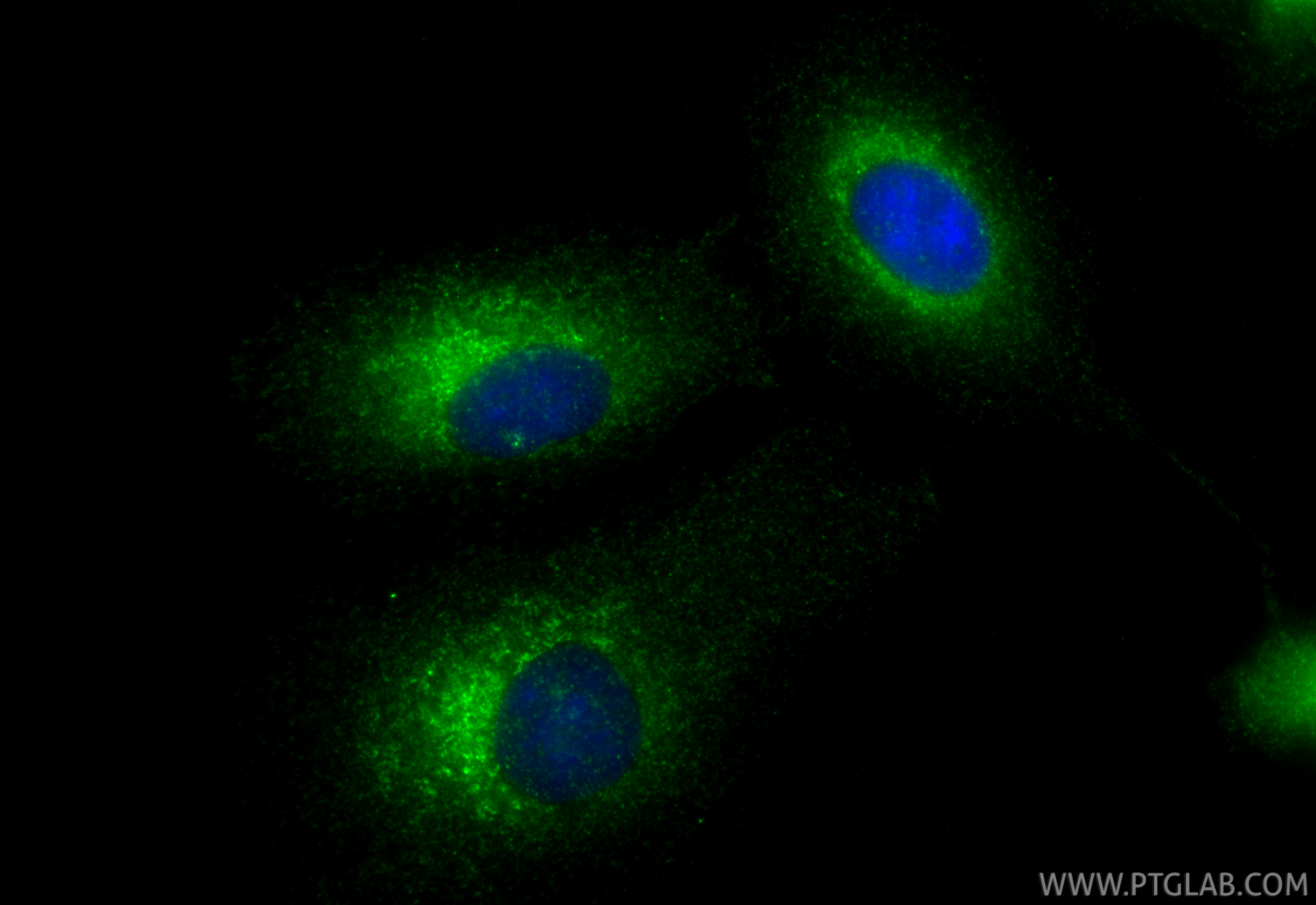 IF Staining of A549 using 14738-1-AP IF Staining of A549 using 14738-1-AP
