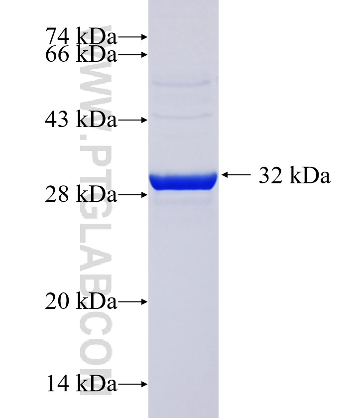 DEFB103B fusion protein Ag37439 SDS-PAGE DEFB103B fusion protein Ag37439 SDS-PAGE