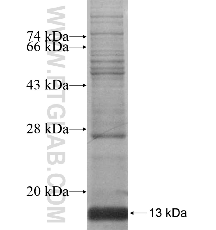 DEFB106B fusion protein Ag16755 SDS-PAGE DEFB106B fusion protein Ag16755 SDS-PAGE