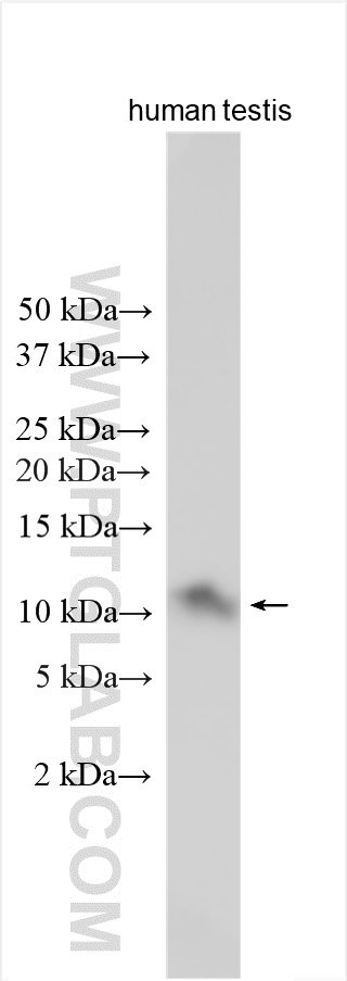 WB analysis using 33236-1-AP