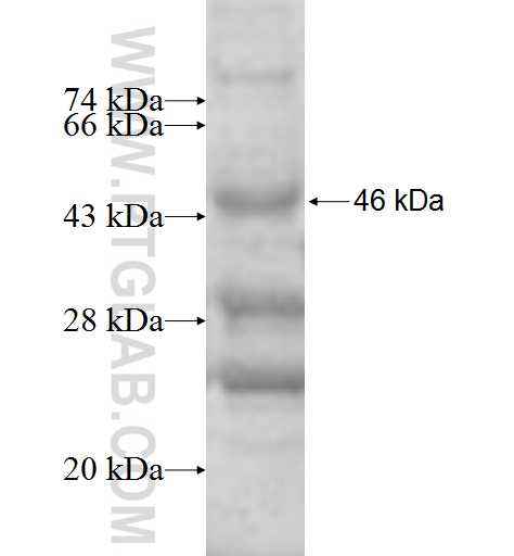 DEFB129 fusion protein Ag9872 SDS-PAGE DEFB129 fusion protein Ag9872 SDS-PAGE