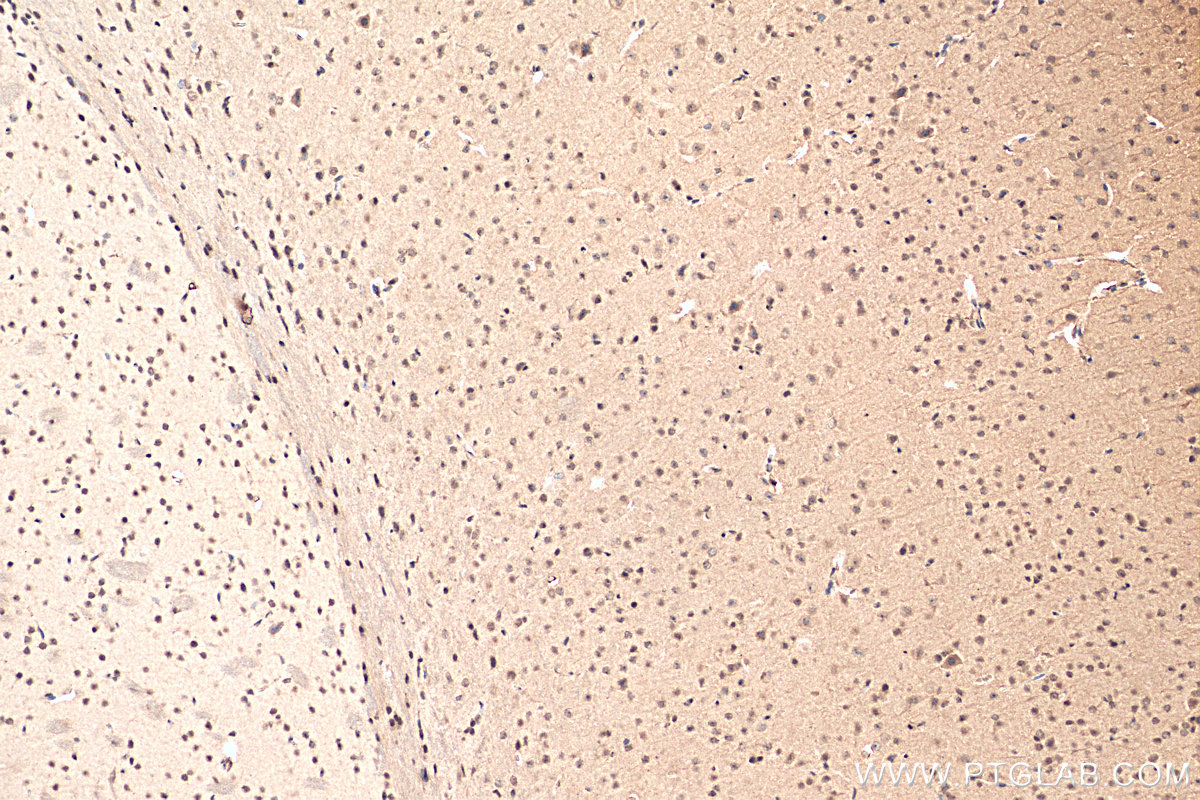 IHC staining of mouse brain using 16448-1-AP
