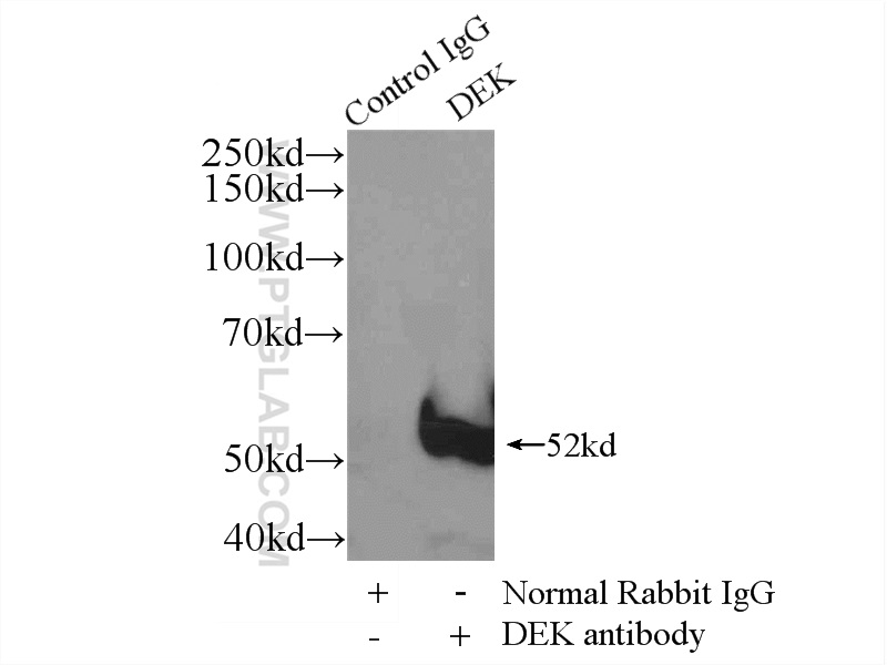 IP experiment of HeLa using 16448-1-AP