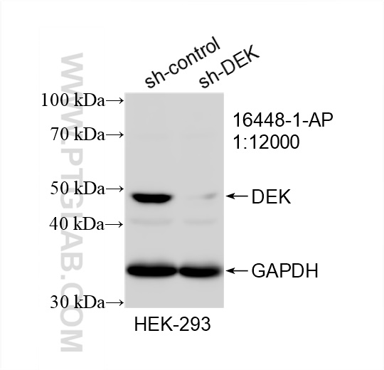WB analysis of HEK-293 using 16448-1-AP