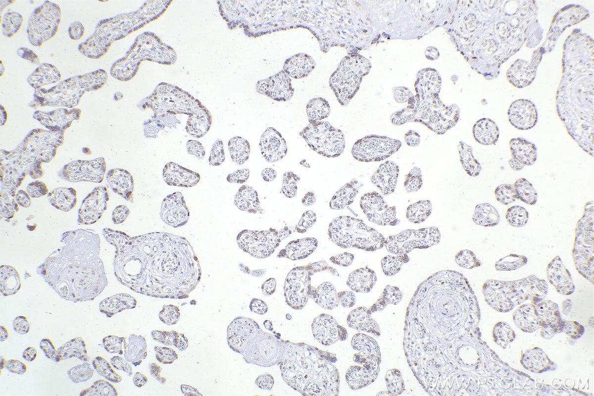 IHC staining of human placenta using 66194-1-Ig