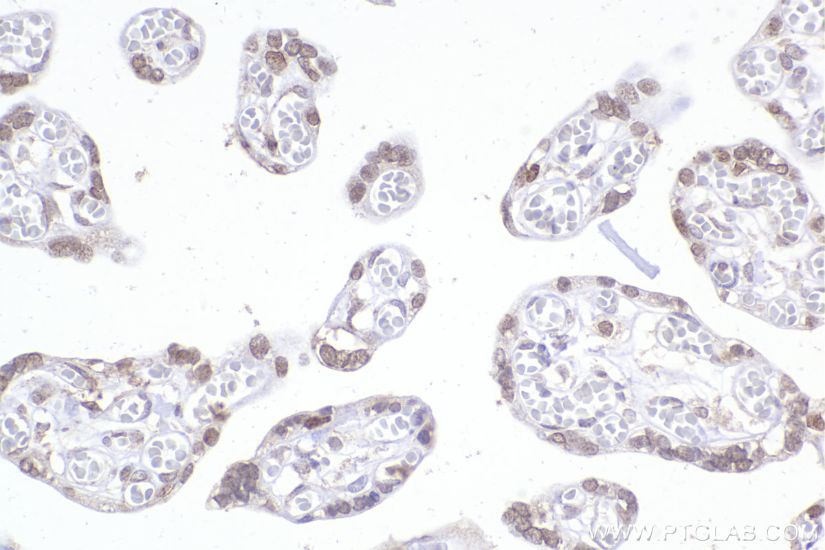 IHC staining of human placenta using 66194-1-Ig