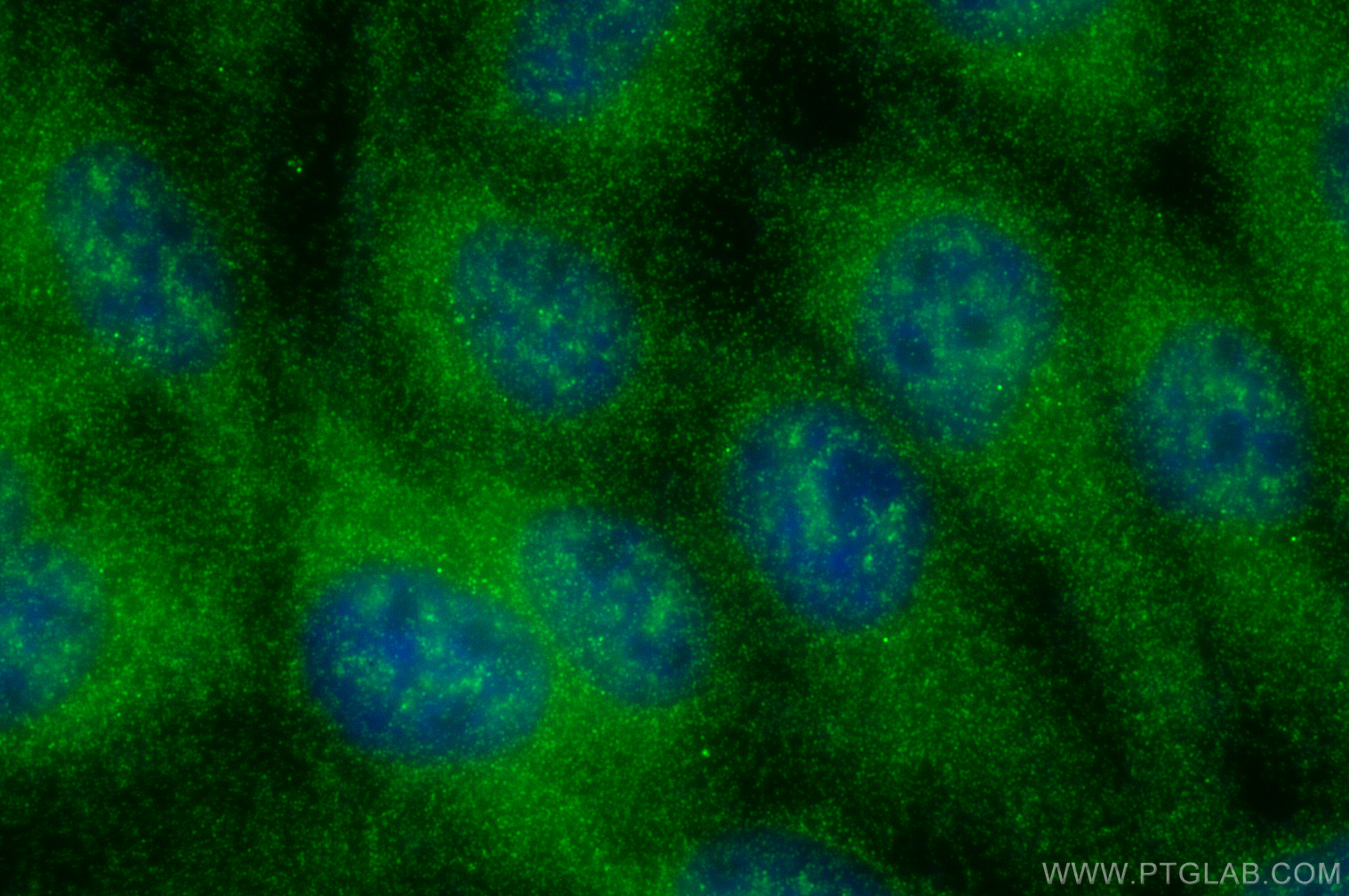 IF Staining of A431 using 25991-1-AP