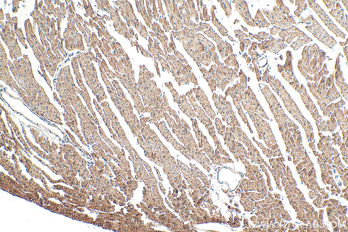 IHC staining of mouse heart using 25991-1-AP