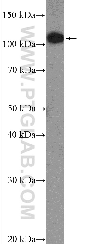 WB analysis of SKOV-3 using 25658-1-AP