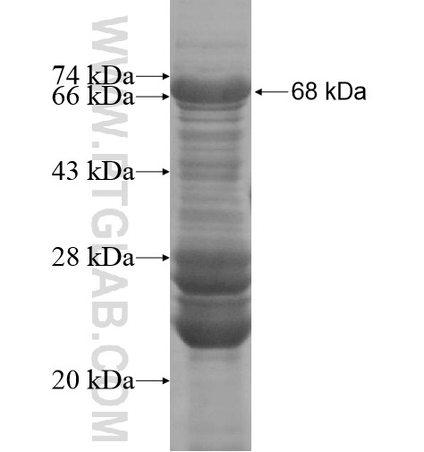 DENND1C fusion protein Ag15113 SDS-PAGE DENND1C fusion protein Ag15113 SDS-PAGE