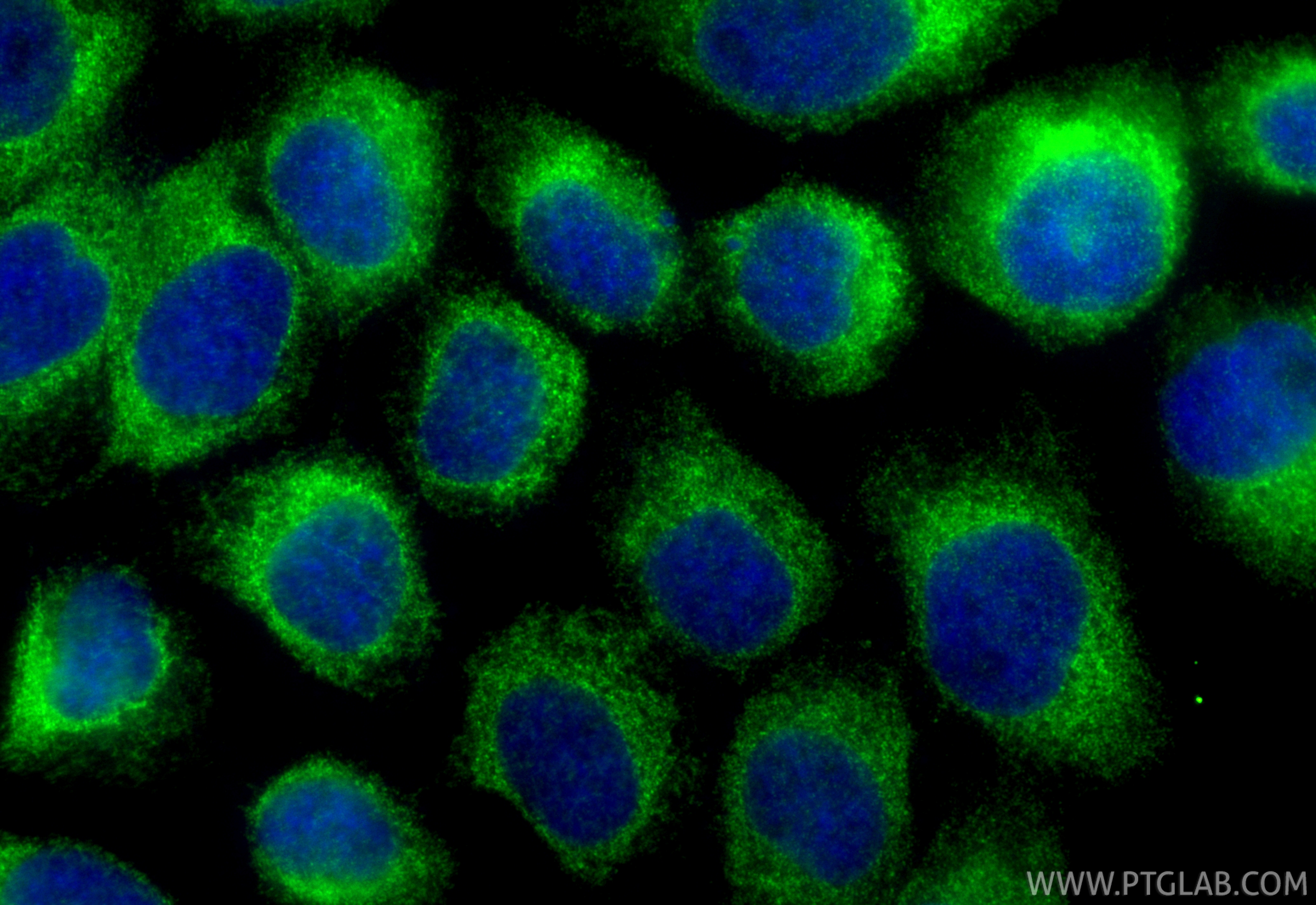 IF Staining of A431 using 33113-1-AP (same clone as 33113-1-PBS)