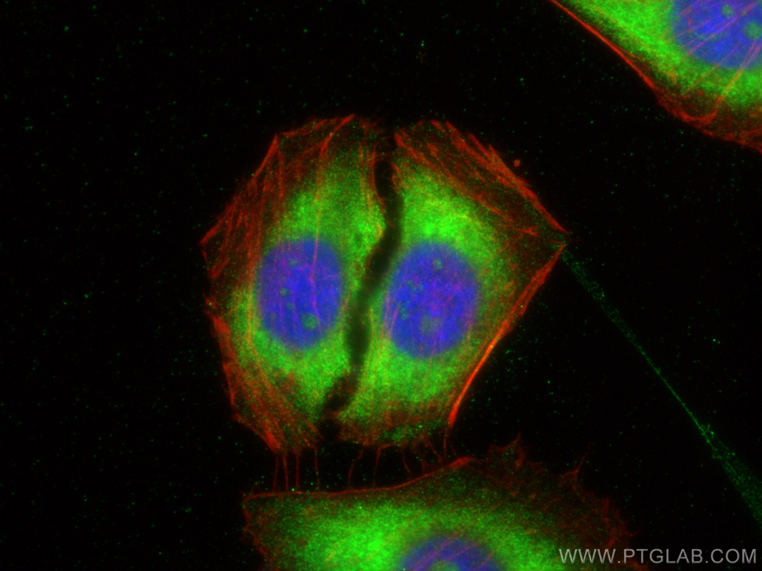 IF Staining of HepG2 using 20985-1-AP