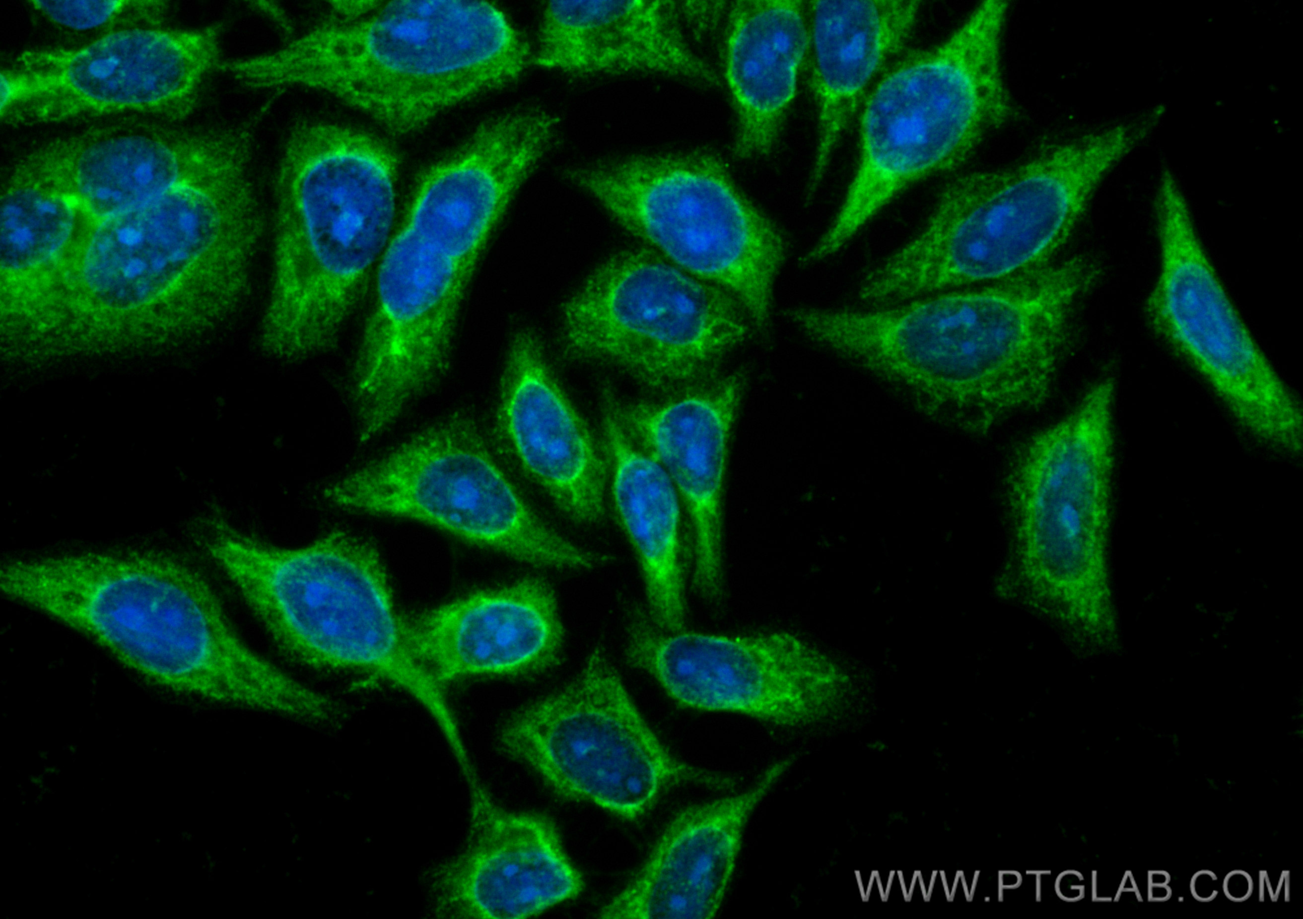 IF Staining of HepG2 using CL488-20985