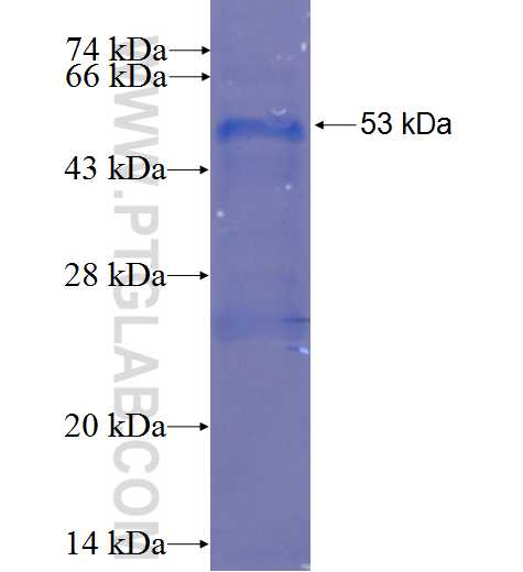 DERL3 fusion protein Ag6784 SDS-PAGE DERL3 fusion protein Ag6784 SDS-PAGE