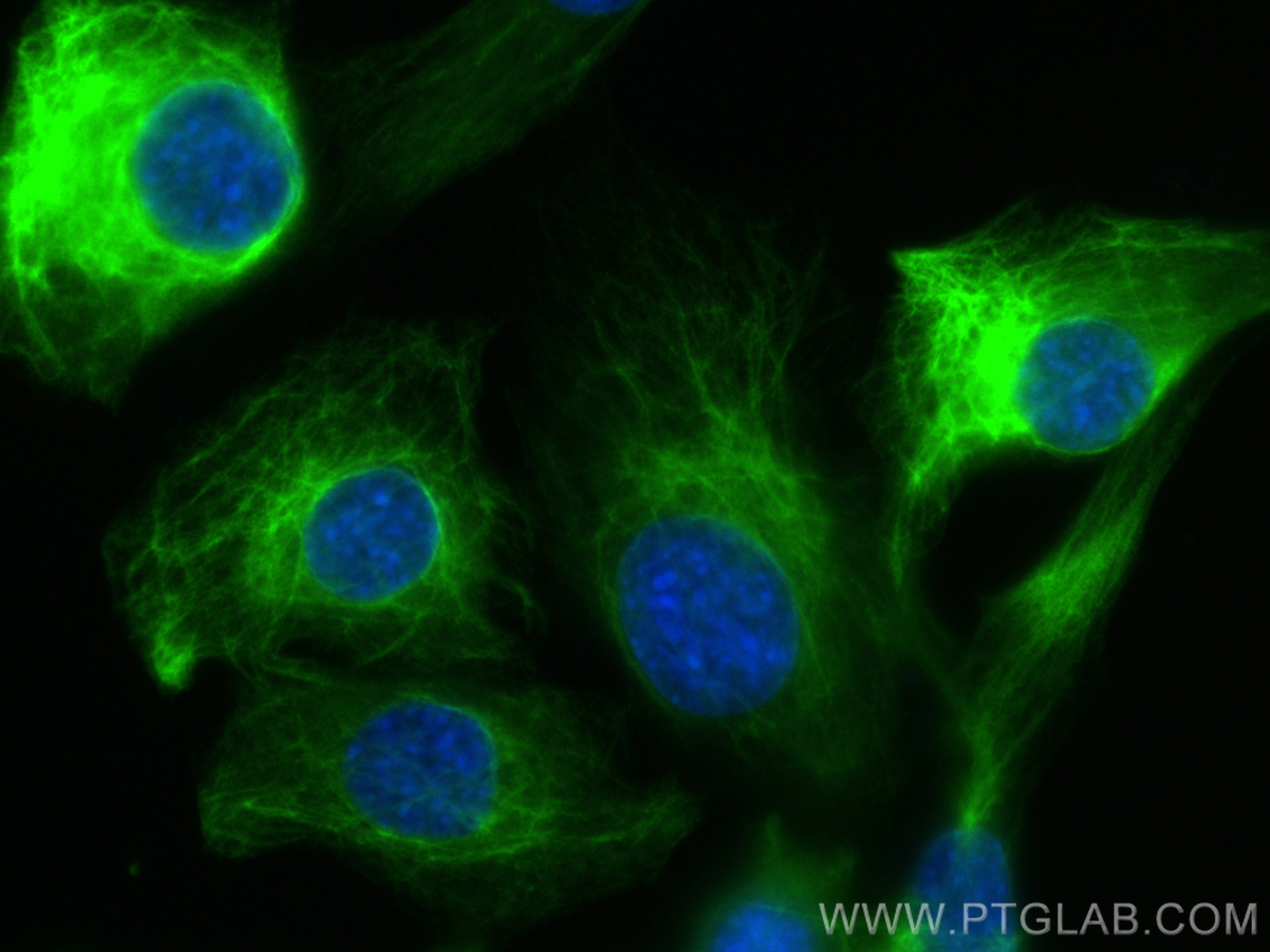 IF Staining of C2C12 using 16520-1-AP