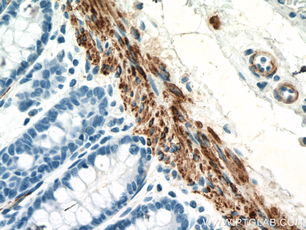 IHC staining of human colon using 16520-1-AP