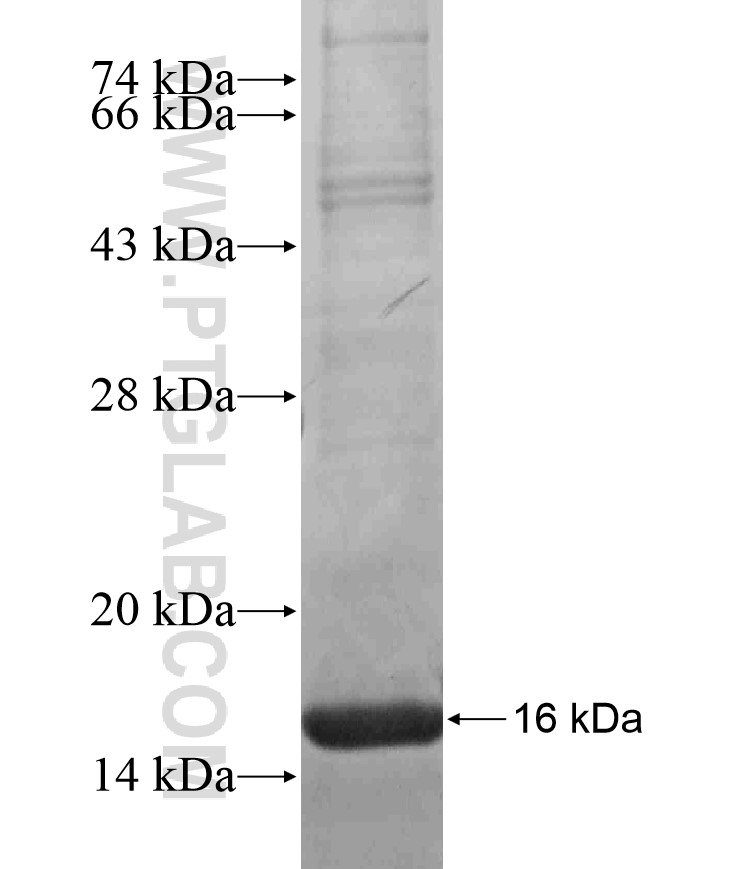 DES fusion protein Ag17653 SDS-PAGE