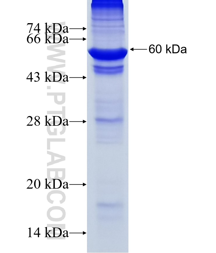 DET1 fusion protein Ag16127 SDS-PAGE DET1 fusion protein Ag16127 SDS-PAGE
