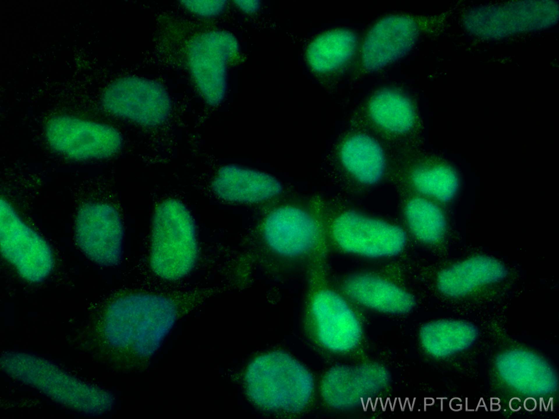 IF Staining of HEK-293 using 68177-1-Ig