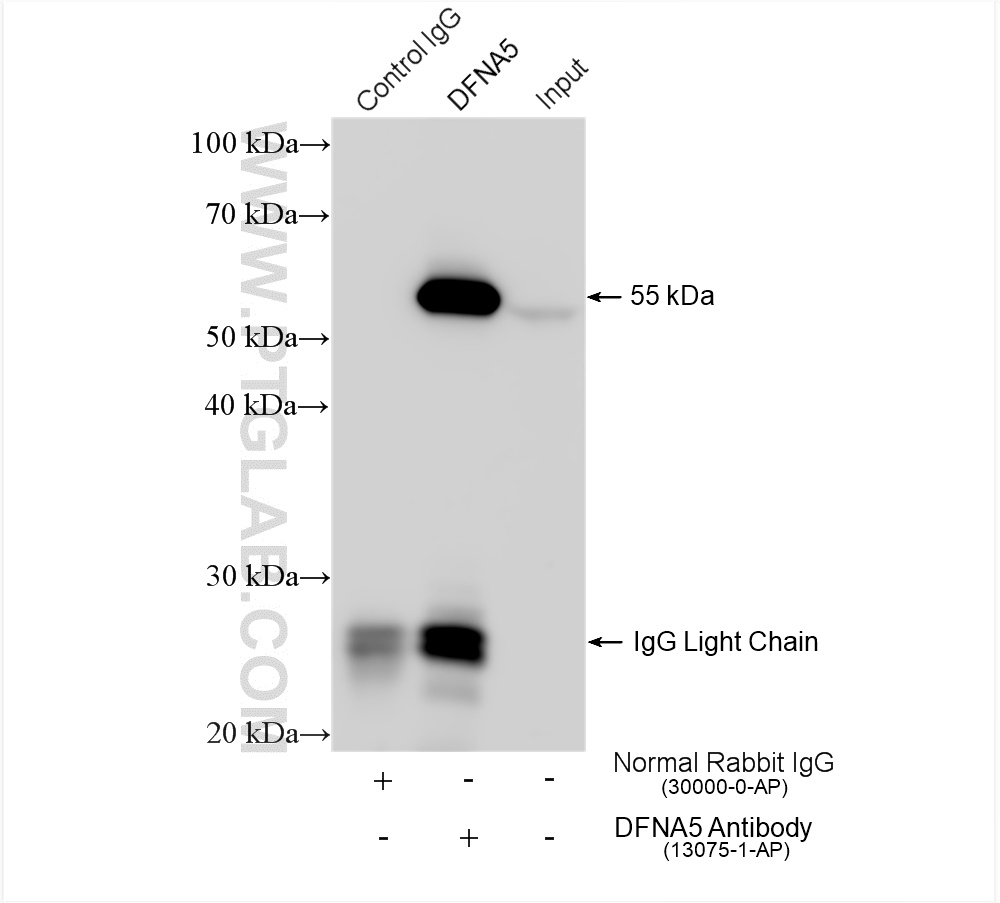 IP experiment of SH-SY5Y using 13075-1-AP