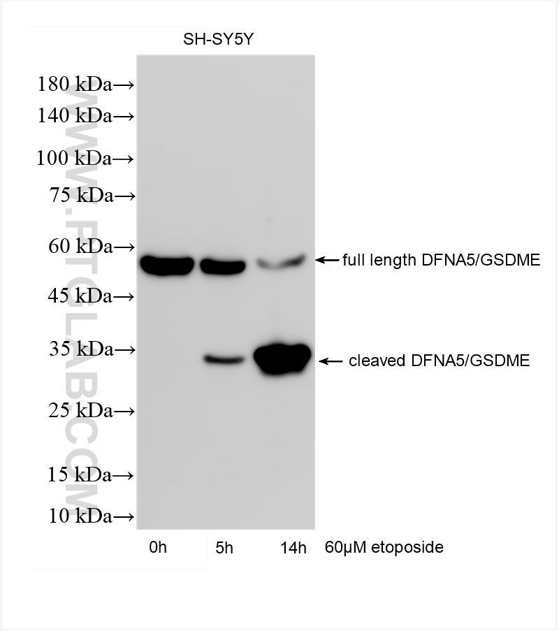 WB analysis of SH-SY5Y using 83454-6-RR