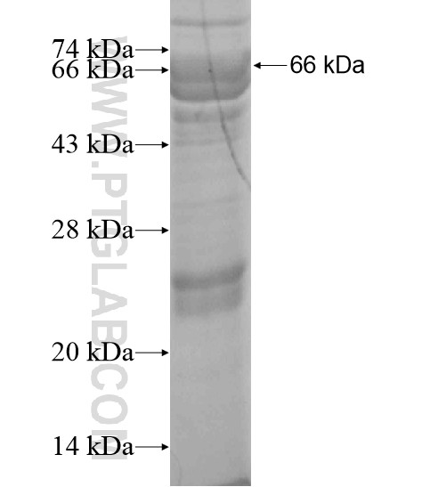 DFNB59 fusion protein Ag20044 SDS-PAGE DFNB59 fusion protein Ag20044 SDS-PAGE