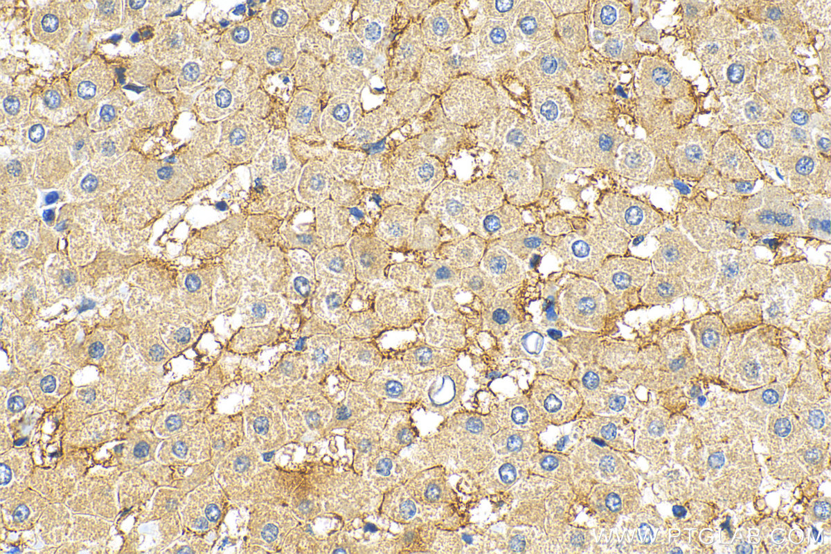 IHC staining of human liver using 17100-1-AP
