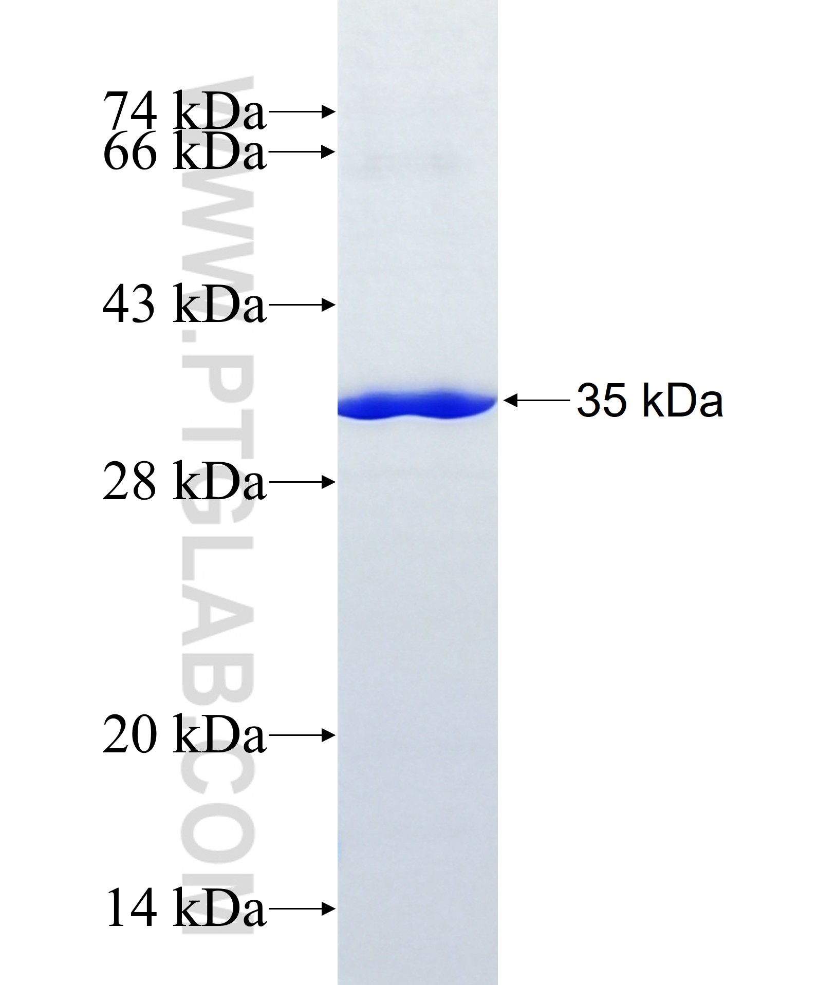 DGAT2 fusion protein Ag10748 SDS-PAGE DGAT2 fusion protein Ag10748 SDS-PAGE