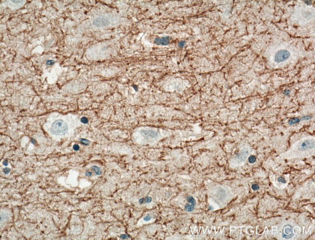 IHC staining of human brain using 13705-1-AP (same clone as 13705-1-PBS)