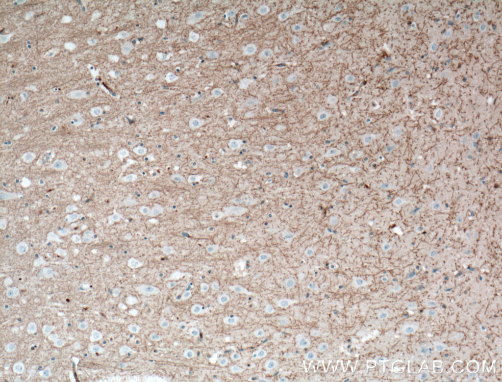 IHC staining of human brain using 13705-1-AP (same clone as 13705-1-PBS)