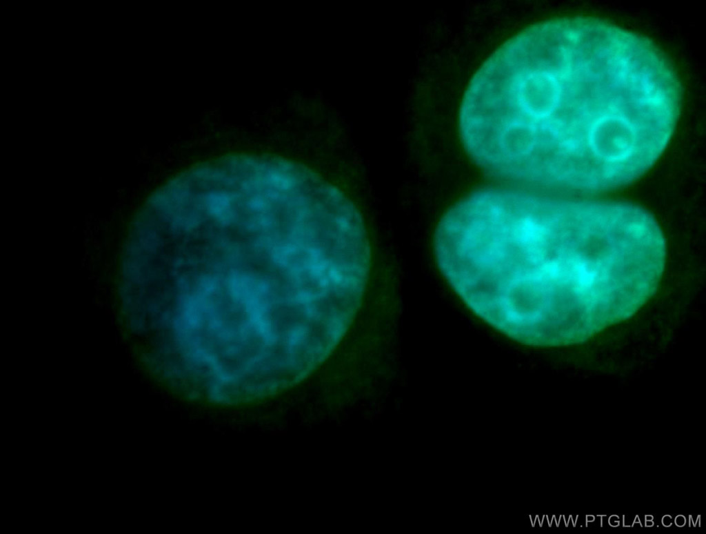 IF analysis of SH-SY5Y cells, using DGCR8 antibody (10996-1-AP) at a 1:50 dilution and FITC-labeled donkey anti-rabbit IgG (green). Blue pseudocolor = DAPI (fluorescent DNA dye)