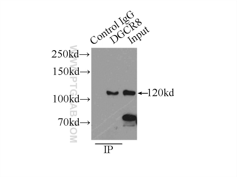 IP experiment of HEK-293 using 10996-1-AP