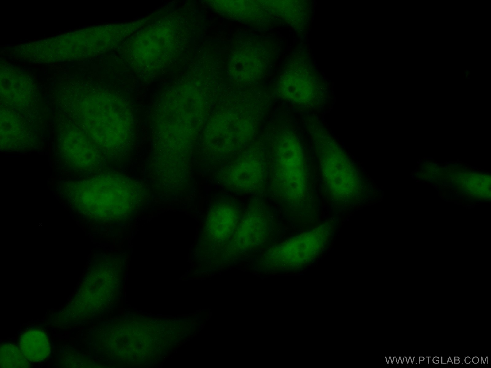 IF Staining of HeLa using 25835-1-AP