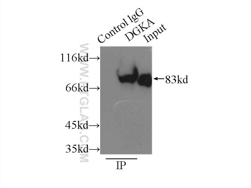 IP experiment of Jurkat using 11547-1-AP