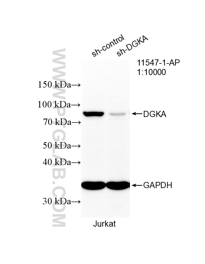 WB analysis of Jurkat using 11547-1-AP WB analysis of Jurkat using 11547-1-AP