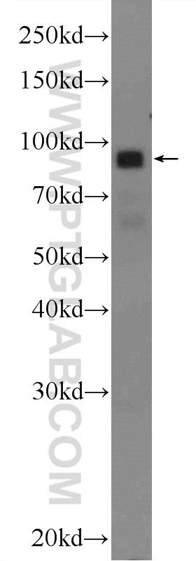 WB analysis of HeLa using 24320-1-AP