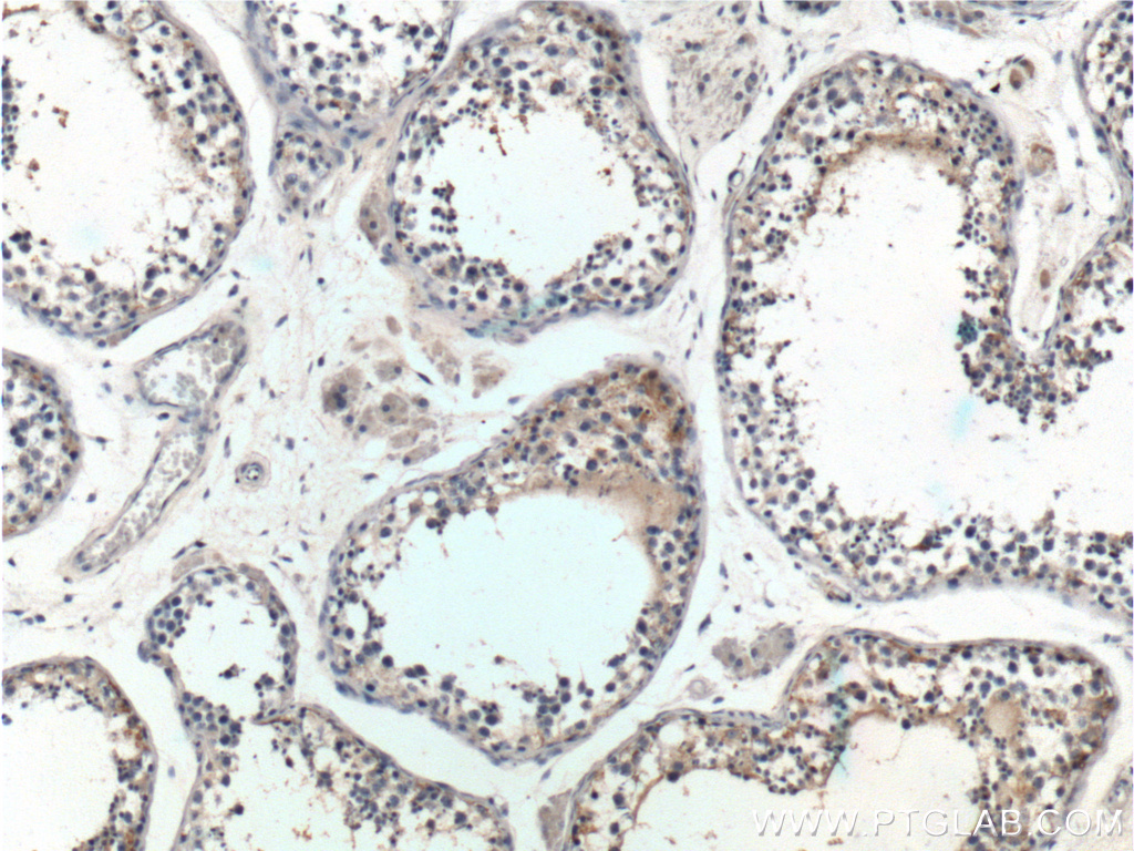 IHC staining of human testis using 13873-1-AP