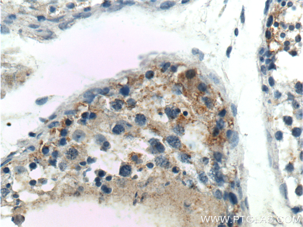 IHC staining of human testis using 13873-1-AP